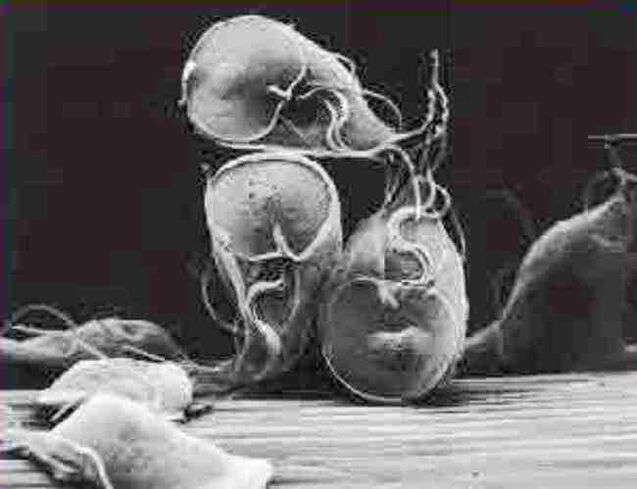 protozoan parasite giardia